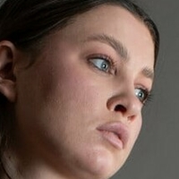 Люсидумус Голая