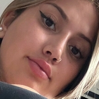 Тдемироз Голая